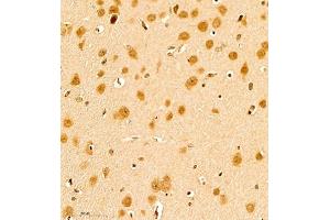 Immunohistochemistry of paraffin embedded rat brain using scr3 (ABIN7074886) at dilution of 1:1000 (400x lens) (NCOA3 anticorps)