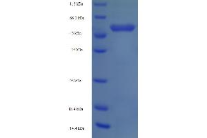SDS-PAGE (SDS) image for 3-Oxoacid CoA Transferase 1 (OXCT1) (AA 40-520) protein (His tag) (ABIN5710057)