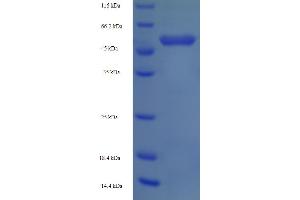 SDS-PAGE (SDS) image for 3-Oxoacid CoA Transferase 1 (OXCT1) (AA 40-520) protein (His tag) (ABIN5710057)
