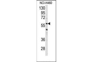 Image no. 1 for anti-Cytochrome P450, Family 3, Subfamily A, Polypeptide 4 (CYP3A4) (Middle Region) antibody (ABIN360097) (CYP3A4 anticorps  (Middle Region))