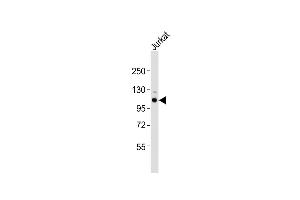 Anti-Uhrf2 Antibody (Center)at 1:1000 dilution + Jurkat whole cell lysates Lysates/proteins at 20 μg per lane. (UHRF2 anticorps  (AA 472-505))
