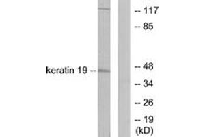 Western blot analysis of extracts from LOVO cells, using Keratin 19 Antibody. (Cytokeratin 19 anticorps  (AA 231-280))