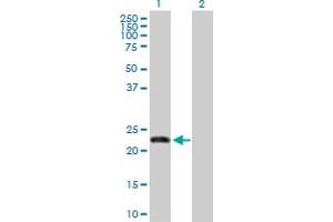 Western Blot analysis of FBXO36 expression in transfected 293T cell line by FBXO36 MaxPab polyclonal antibody. (FBXO36 anticorps  (AA 1-188))