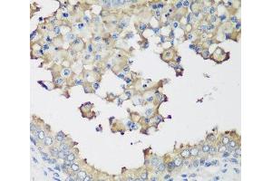 Immunohistochemistry of paraffin-embedded Human prostate using NEDD4L Polyclonal Antibody at dilution of 1:200 (40x lens).
