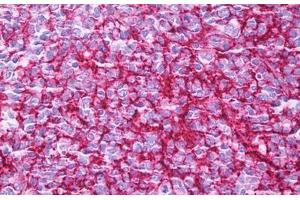 Anti-CD35 antibody IHC staining of human tonsil, germinal center.