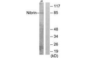 Western blot analysis of extracts from Jurkat cells, using Nibrin (Ab-278) Antibody. (Nibrin anticorps  (AA 251-300))