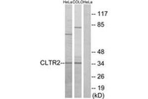 Western blot analysis of extracts from HeLa/COLO cells, using CLTR2 Antibody. (CasLTR2 anticorps  (AA 281-330))