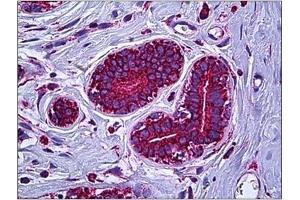 Human Breast: Formalin-Fixed, Paraffin-Embedded (FFPE)