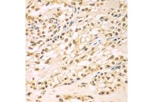 Immunohistochemistry of paraffin-embedded human kidney using TBL1XR1 antibody (ABIN5975754) at dilution of 1/100 (40x lens).