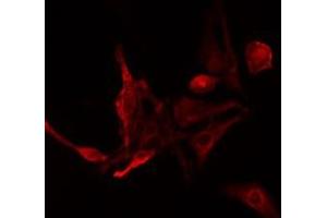 ABIN6275480 staining NIH-3T3 cells by IF/ICC. (RGS14 anticorps  (Internal Region))
