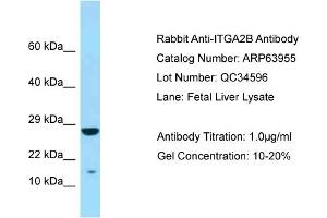 Western Blotting (WB) image for anti-Integrin Alpha2b (CD41) (N-Term) antibody (ABIN2789680) (Integrin Alpha2b anticorps  (N-Term))