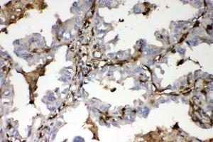 IHC analysis of S100A4 using anti-S100A4 antibody (ABIN7600462). (s100a4 anticorps  (AA 2-101))