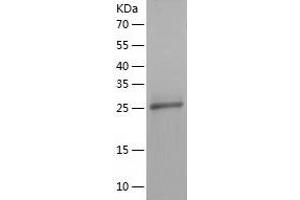 Western Blotting (WB) image for HAUS Augmin-Like Complex, Subunit 1 (HAUS1) (AA 1-278) protein (His-IF2DI Tag) (ABIN7123254)