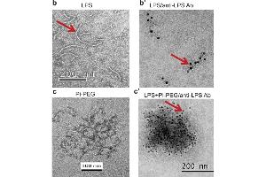 immunoelectron microscopy (IEM) images of LPS using ABIN479062. (Lipopolysaccharides (LPS) anticorps)