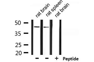 Western blot analysis of extracts from  rat brain and rat spleen, using ZADH2 Antibody. (ZADH2 anticorps  (Internal Region))