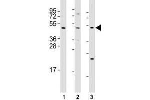 Western blot testing of Mlkl antibody at 1:2000 dilution and mouse samples: (1) testis, (2) liver, (3) NIH3T3 lysate; Predicted size: 54 kDa. (MLKL anticorps  (AA 444-472))