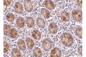 Immunohistochemistry of AATF in human small intestine tissue with AATF antibody at 10 μg/ml.