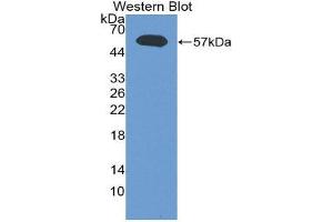 Western Blotting (WB) image for anti-Lymphotoxin-alpha (LTA) (AA 35-191) antibody (ABIN1860799)