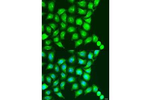 Immunofluorescence analysis of U2OS cells using UBIAD1 antibody (ABIN2737790) at dilution of 1:100. (UBIAD1 anticorps)