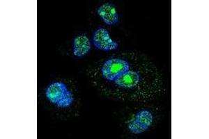 Confocal immunofluorescent analysis with HepG2 cells using SREBF2 / SREBP2  Antibody , followed by Alexa Fluor 488-conjugated goat anti-rabbit lgG (green).