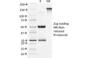 SDS-PAGE Analysis Purified CD71 Mouse Monoclonal Antibody (TFRC/1396).