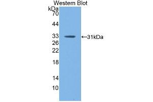 Western blot analysis of the recombinant protein. (F13A1 anticorps  (AA 372-616))