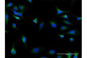 Immunofluorescence of purified MaxPab antibody to DIAPH1 on HeLa cell.