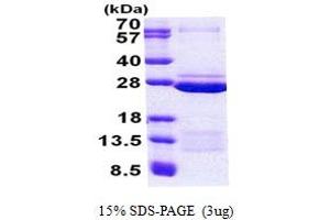 SDS-PAGE (SDS) image for Family with Sequence Similarity 50, Member A (FAM50A) (AA 150-339) protein (His tag) (ABIN5852994) (FAM50A Protein (AA 150-339) (His tag))