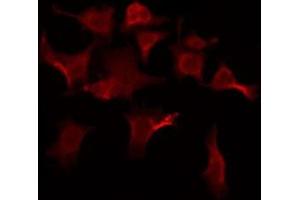 ABIN6276097 staining Hela by IF/ICC.