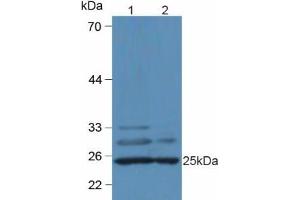 Western blot analysis of (1) Mouse Heart Tissue and (2) Mouse Liver Tissue. (C1QA anticorps  (AA 23-245))