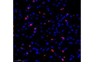 Immunofluorescence of paraffin embedded mouse brain using MAP7 (ABIN7074621) at dilution of 1:400 (300x lens)