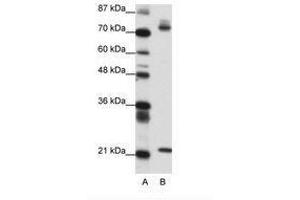 Image no. 1 for anti-SATB Homeobox 1 (SATB1) (AA 611-660) antibody (ABIN6736150) (SATB1 anticorps  (AA 611-660))