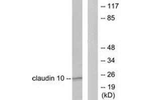 Western blot analysis of extracts from LOVO cells, using Claudin 10 Antibody. (CLDN10 anticorps  (AA 179-228))