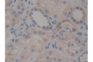 Detection of STAT2 in Human Kidney Tissue using Polyclonal Antibody to Signal Transducer And Activator Of Transcription 2 (STAT2)