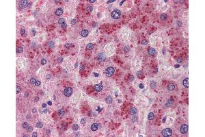 Anti-FGF21 antibody IHC of human liver.