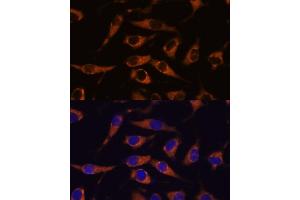 Immunofluorescence analysis of L929 cells using SM antibody (ABIN7270612) at dilution of 1:100.