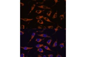 Immunofluorescence analysis of L929 cells using SM antibody (ABIN7270612) at dilution of 1:100. (SMAP1 anticorps  (AA 180-250))