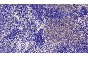 Detection of NGAL in Rat Spleen Tissue using Polyclonal Antibody to Neutrophil gelatinase-associated lipocalin (NGAL)