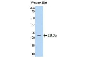 Western Blotting (WB) image for anti-Interleukin 3 Receptor, alpha (IL3RA) (AA 167-331) antibody (ABIN3206514) (IL3RA anticorps  (AA 167-331))