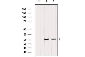 Western blot analysis of extracts from various samples, using CD81 Antibody. (CD81 anticorps  (Internal Region))