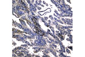 IHC analysis of NADPH oxidase 4 using anti-NADPH oxidase 4 antibody .