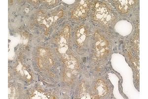 ABIN6260779 and ABIN6273207 at 1/100 staining human normal kidney tissue by IHC-P. (CFHR3 anticorps  (Internal Region))