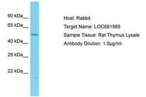 VIPAR anticorps  (AA 101-150)