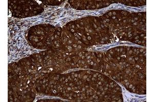 Image no. 1 for anti-Non-Metastatic Cells 1, Protein (NM23A) Expressed in (NME1) antibody (ABIN1499754)