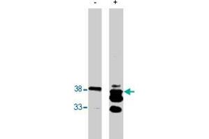 Western blot analysis using PPAP2B polyclonal antibody  on bacterially expressed PPAP2B protein when untreated (-) and treated with with 0. (PPAP2B anticorps)