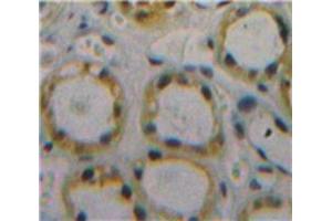 Used in DAB staining on fromalin fixed paraffin-embedded Kidney tissue