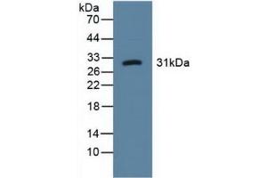 Detection of LOX1 in Human Urine using Polyclonal Antibody to Lectin Like Oxidized Low Density Lipoprotein Receptor 1 (LOX1) (OLR1 anticorps  (AA 81-273))
