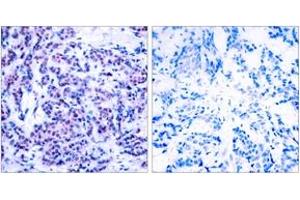 Immunohistochemistry (IHC) image for anti-Jun D Proto-Oncogene (JUND) (pSer255) antibody (ABIN2888460) (JunD anticorps  (pSer255))