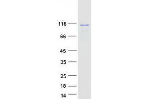 Validation with Western Blot