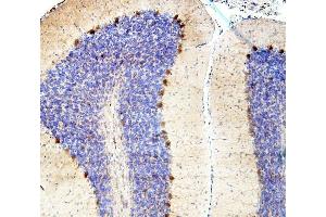 IHC analysis of SMAD2 using anti-SMAD2 antibody (ABIN6719361). (SMAD2 anticorps  (AA 83-264))
